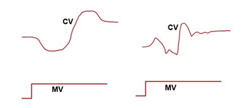 Figure 4. Complex and ugly high order transfer functions